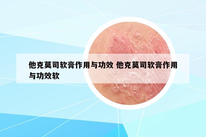 他克莫司軟膏作用與功效 他克莫司軟膏作用與功效軟