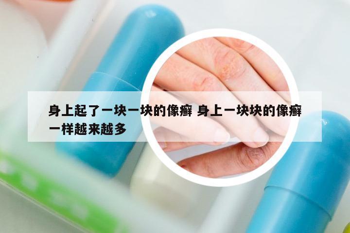 身上起了一塊一塊的像癬 身上一塊塊的像癬一樣越來越多