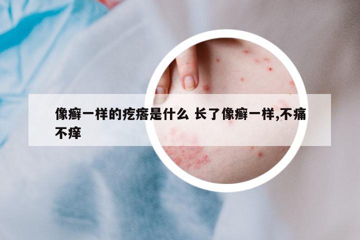 像癬一樣的疙瘩是什么 長(zhǎng)了像癬一樣,不痛不癢