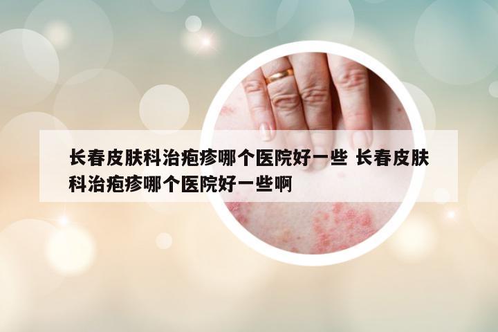 長春皮膚科治皰疹哪個(gè)醫(yī)院好一些 長春皮膚科治皰疹哪個(gè)醫(yī)院好一些啊
