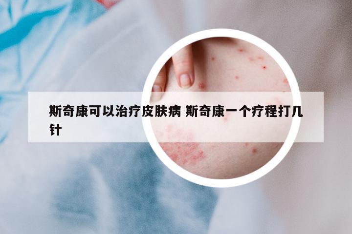 斯奇康可以治療皮膚病 斯奇康一個(gè)療程打幾針