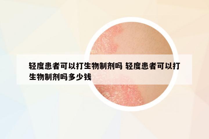輕度患者可以打生物制劑嗎 輕度患者可以打生物制劑嗎多少錢