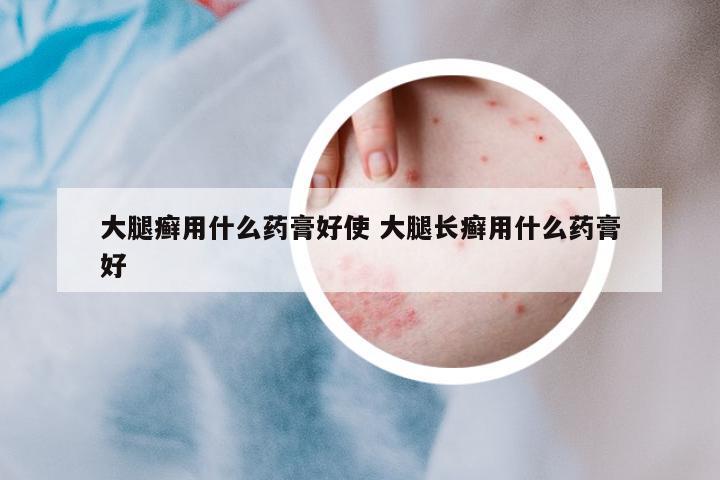 大腿癬用什么藥膏好使 大腿長癬用什么藥膏好
