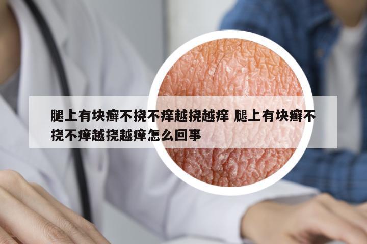 腿上有塊癬不撓不癢越撓越癢 腿上有塊癬不撓不癢越撓越癢怎么回事