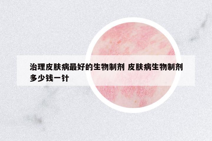治理皮膚病最好的生物制劑 皮膚病生物制劑多少錢一針