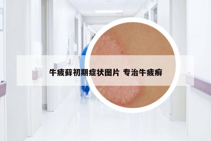 牛疲蘚初期癥狀圖片 專治牛疲癬