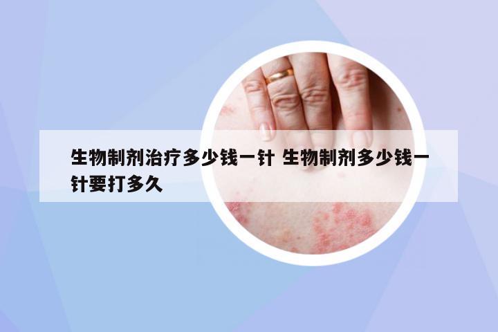 生物制劑治療多少錢一針 生物制劑多少錢一針要打多久