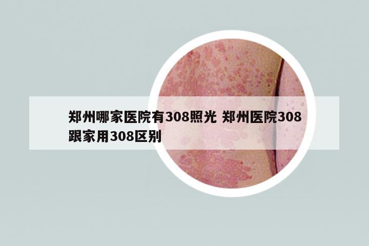 鄭州哪家醫(yī)院有308照光 鄭州醫(yī)院308跟家用308區(qū)別