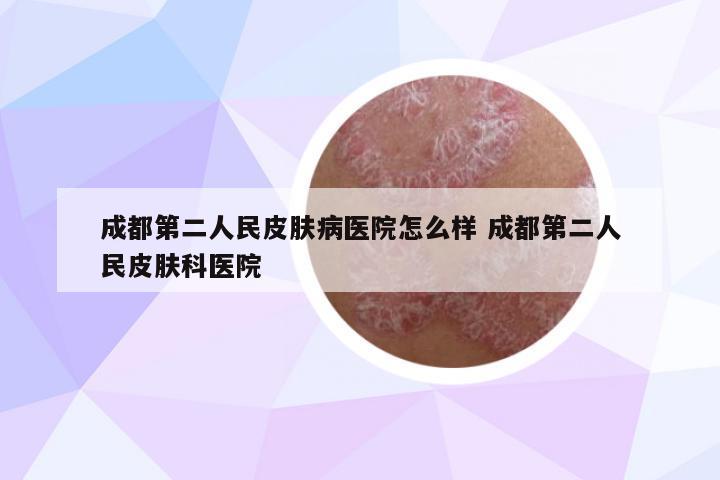 成都第二人民皮膚病醫(yī)院怎么樣 成都第二人民皮膚科醫(yī)院