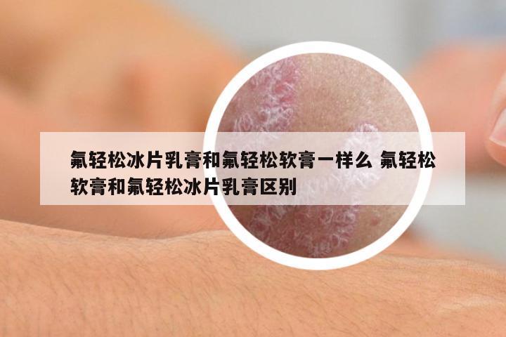 氟輕松冰片乳膏和氟輕松軟膏一樣么 氟輕松軟膏和氟輕松冰片乳膏區(qū)別