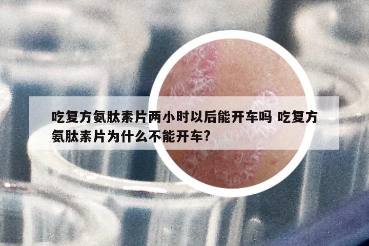 吃復(fù)方氨肽素片兩小時(shí)以后能開車嗎 吃復(fù)方氨肽素片為什么不能開車?