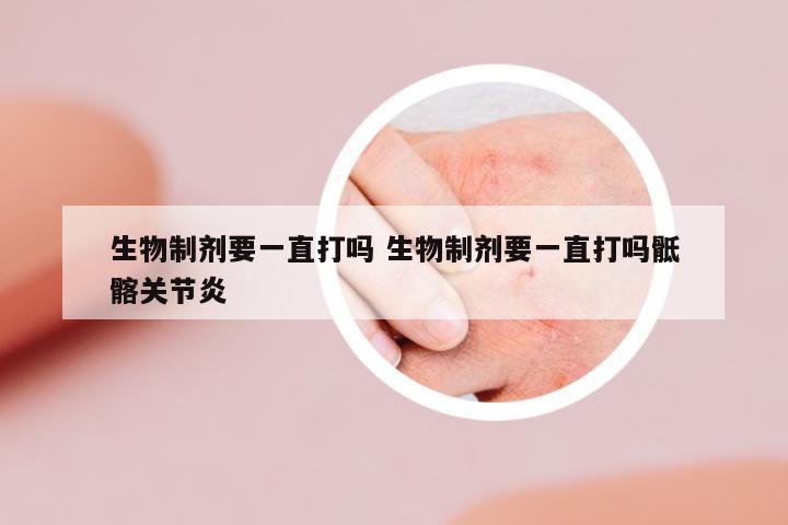 生物制劑要一直打嗎 生物制劑要一直打嗎骶髂關(guān)節(jié)炎