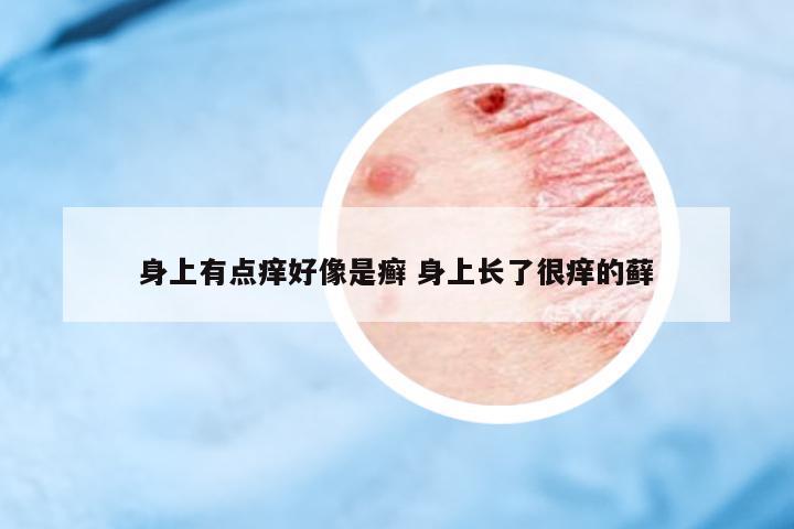 身上有點癢好像是癬 身上長了很癢的蘚