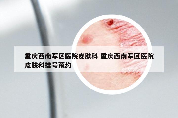 重慶西南軍區(qū)醫(yī)院皮膚科 重慶西南軍區(qū)醫(yī)院皮膚科掛號(hào)預(yù)約