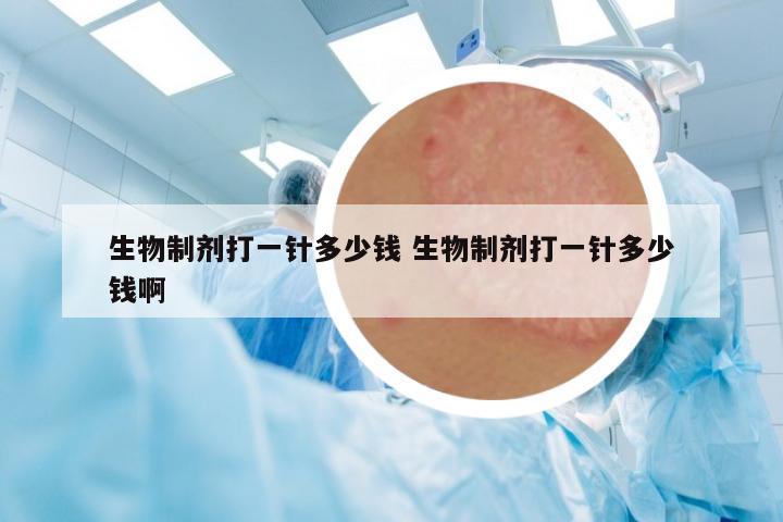 生物制劑打一針多少錢 生物制劑打一針多少錢啊