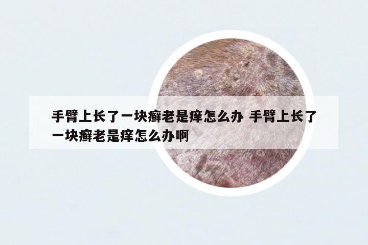 手臂上長了一塊癬老是癢怎么辦 手臂上長了一塊癬老是癢怎么辦啊