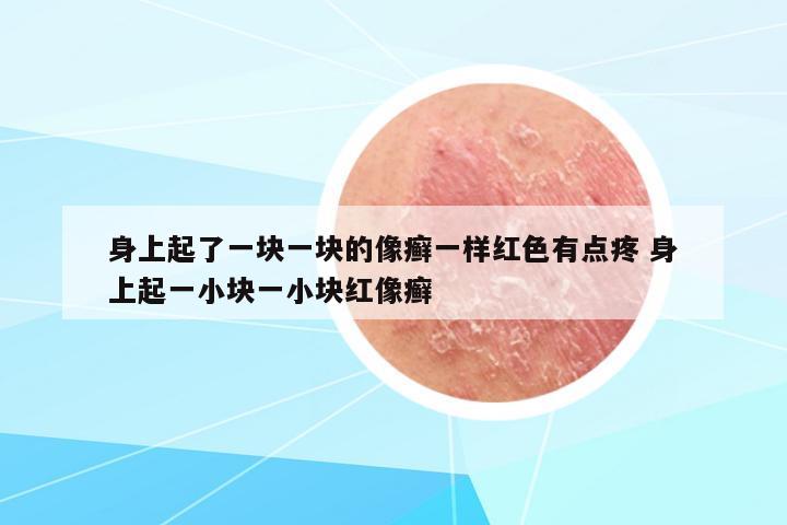 身上起了一塊一塊的像癬一樣紅色有點(diǎn)疼 身上起一小塊一小塊紅像癬
