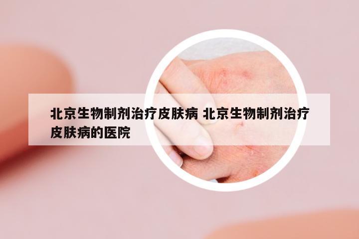 北京生物制劑治療皮膚病 北京生物制劑治療皮膚病的醫(yī)院