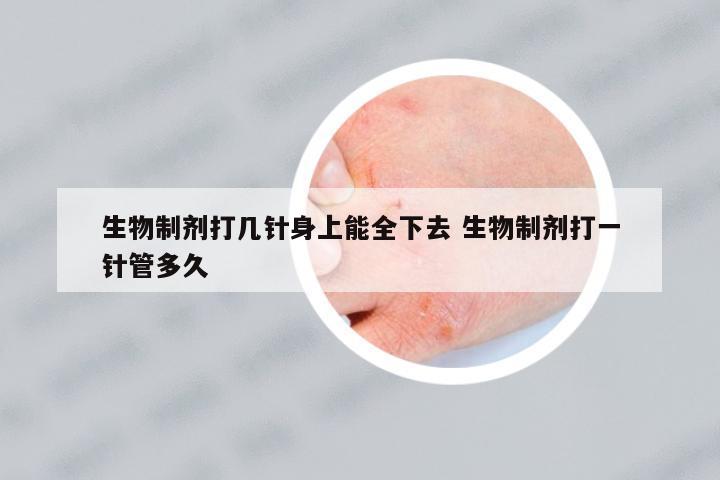 生物制劑打幾針身上能全下去 生物制劑打一針管多久