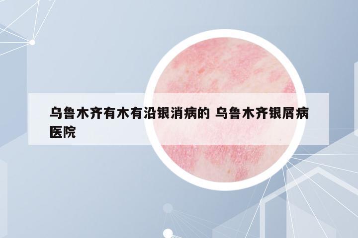 烏魯木齊有木有沿銀消病的 烏魯木齊銀屑病醫(yī)院