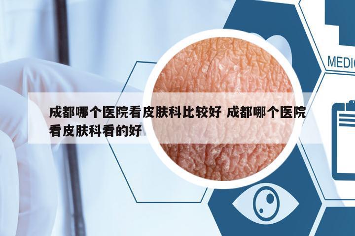 成都哪個(gè)醫(yī)院看皮膚科比較好 成都哪個(gè)醫(yī)院看皮膚科看的好