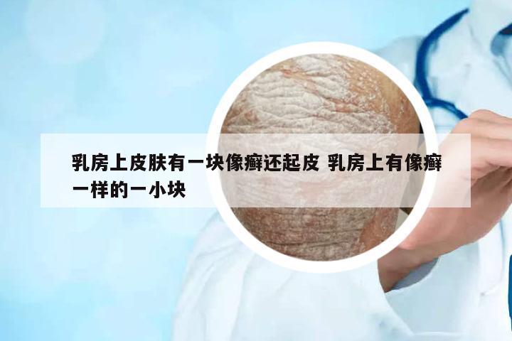 乳房上皮膚有一塊像癬還起皮 乳房上有像癬一樣的一小塊