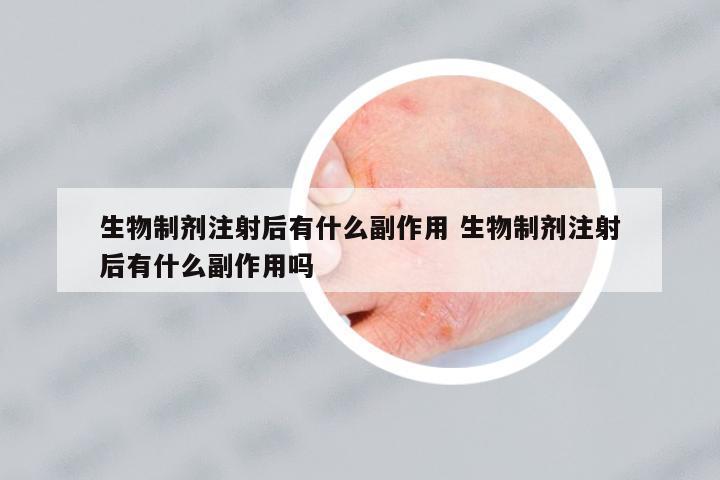 生物制劑注射后有什么副作用 生物制劑注射后有什么副作用嗎