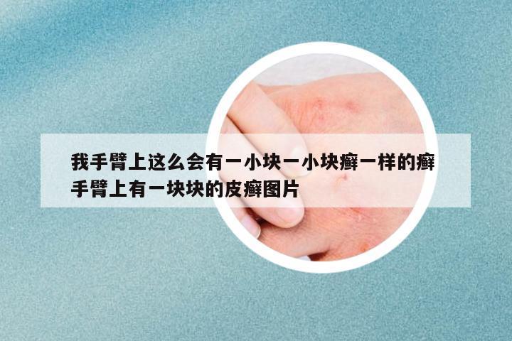 我手臂上這么會有一小塊一小塊癬一樣的癬 手臂上有一塊塊的皮癬圖片