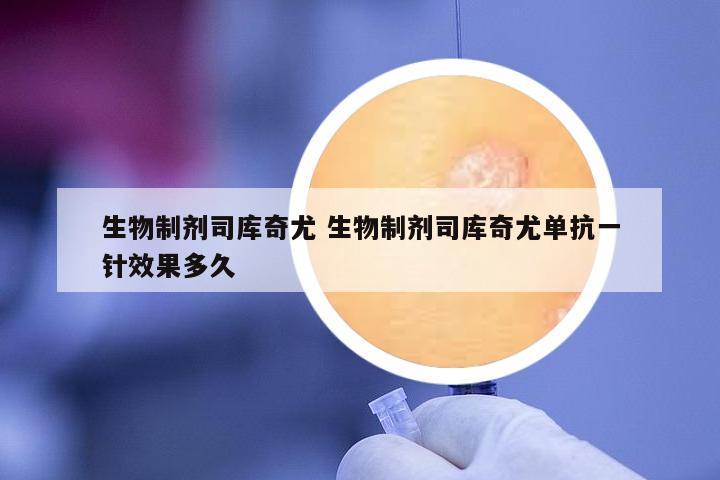 生物制劑司庫奇尤 生物制劑司庫奇尤單抗一針效果多久