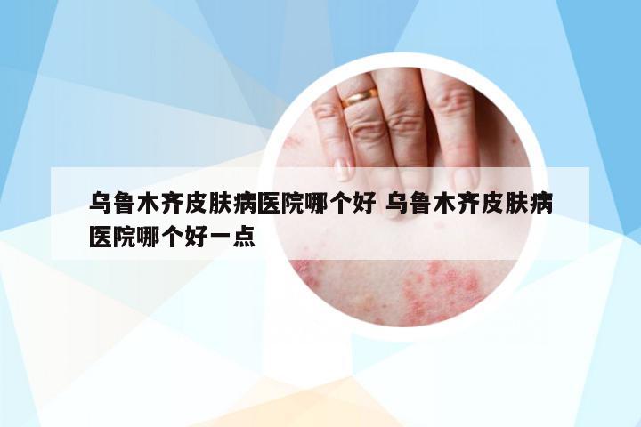 烏魯木齊皮膚病醫(yī)院哪個(gè)好 烏魯木齊皮膚病醫(yī)院哪個(gè)好一點(diǎn)