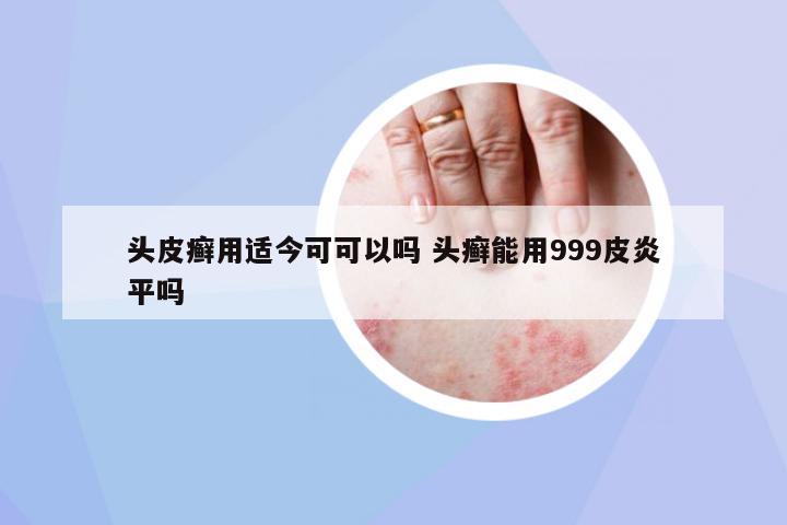 頭皮癬用適今可可以嗎 頭癬能用999皮炎平嗎