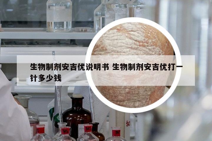 生物制劑安吉優(yōu)說明書 生物制劑安吉優(yōu)打一針多少錢