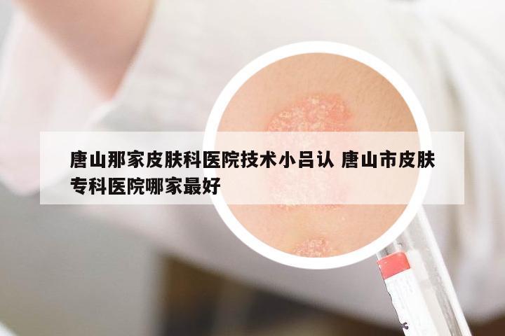 唐山那家皮膚科醫(yī)院技術(shù)小呂認(rèn) 唐山市皮膚專科醫(yī)院哪家最好