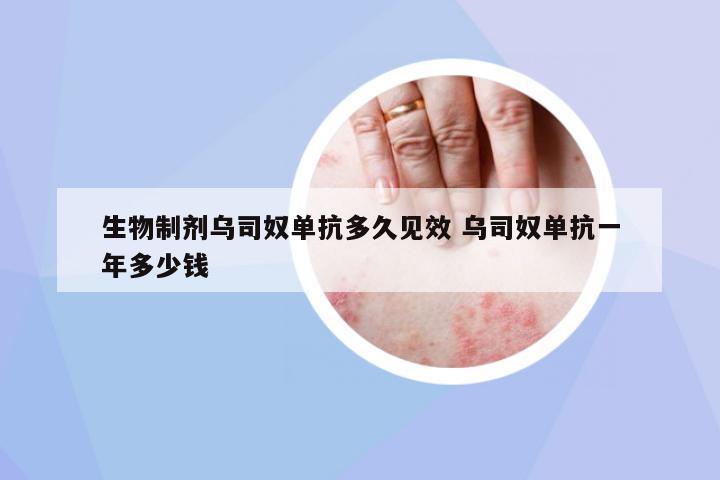 生物制劑烏司奴單抗多久見(jiàn)效 烏司奴單抗一年多少錢(qián)