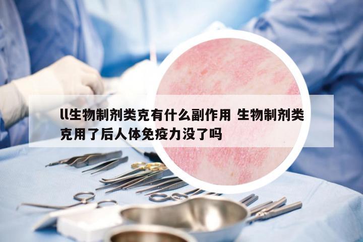 ll生物制劑類克有什么副作用 生物制劑類克用了后人體免疫力沒(méi)了嗎