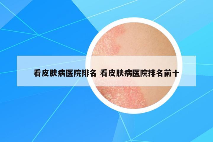 看皮膚病醫(yī)院排名 看皮膚病醫(yī)院排名前十