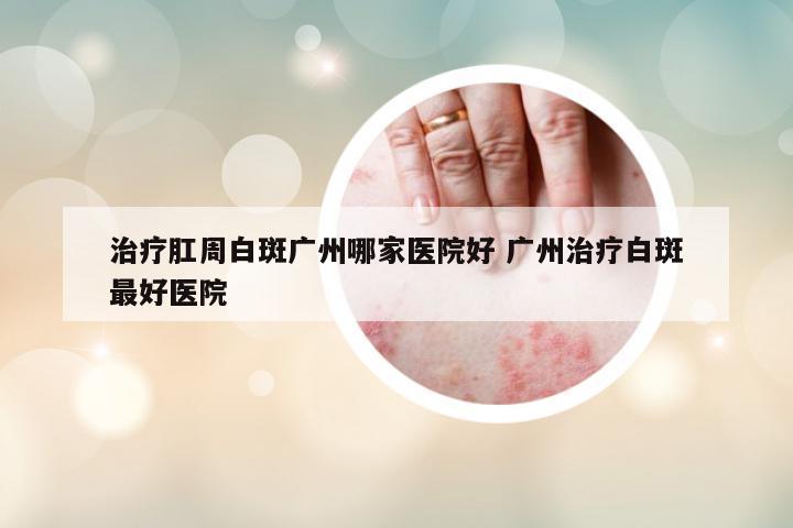 治療肛周白斑廣州哪家醫(yī)院好 廣州治療白斑最好醫(yī)院