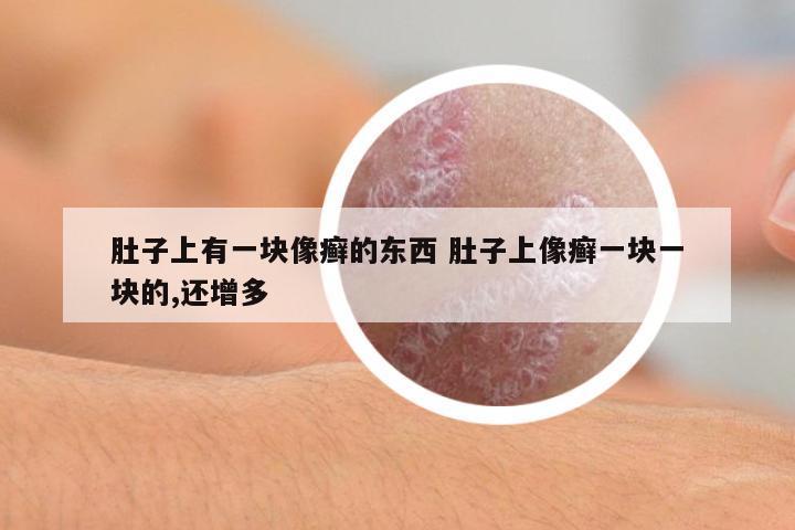 肚子上有一塊像癬的東西 肚子上像癬一塊一塊的,還增多