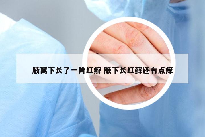 腋窩下長了一片紅癬 腋下長紅蘚還有點癢