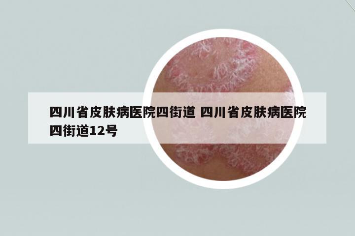 四川省皮膚病醫(yī)院四街道 四川省皮膚病醫(yī)院四街道12號