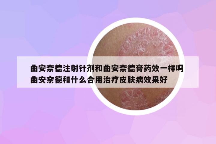 曲安奈德注射針劑和曲安奈德膏藥效一樣嗎 曲安奈德和什么合用治療皮膚病效果好