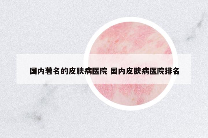 國(guó)內(nèi)著名的皮膚病醫(yī)院 國(guó)內(nèi)皮膚病醫(yī)院排名