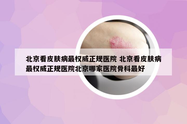 北京看皮膚病最權(quán)威正規(guī)醫(yī)院 北京看皮膚病最權(quán)威正規(guī)醫(yī)院北京哪家醫(yī)院骨科最好
