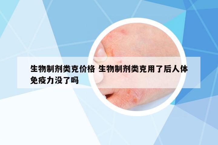 生物制劑類克價(jià)格 生物制劑類克用了后人體免疫力沒了嗎