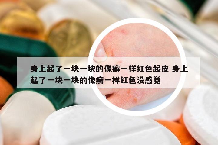 身上起了一塊一塊的像癬一樣紅色起皮 身上起了一塊一塊的像癬一樣紅色沒感覺