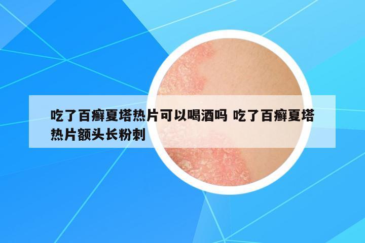 吃了百癬夏塔熱片可以喝酒嗎 吃了百癬夏塔熱片額頭長粉刺