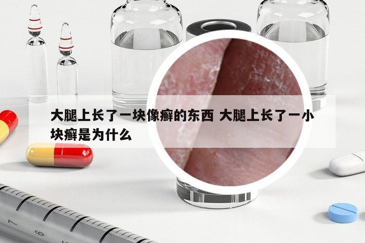 大腿上長了一塊像癬的東西 大腿上長了一小塊癬是為什么