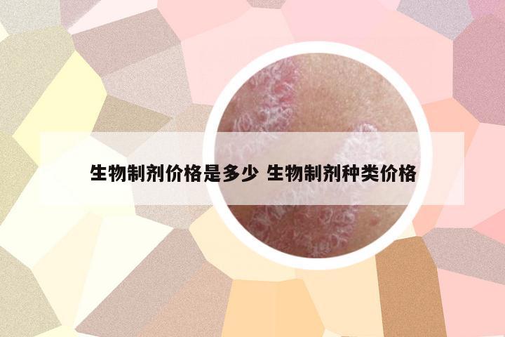 生物制劑價格是多少 生物制劑種類價格