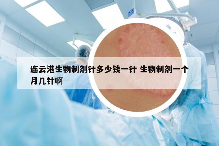 連云港生物制劑針多少錢一針 生物制劑一個(gè)月幾針啊