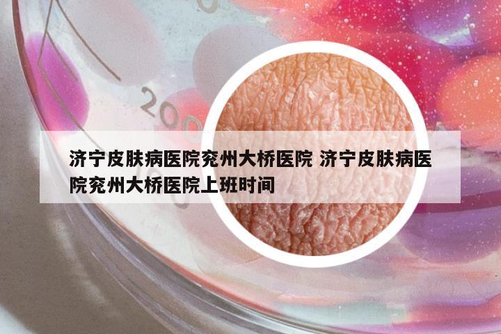 濟寧皮膚病醫(yī)院兗州大橋醫(yī)院 濟寧皮膚病醫(yī)院兗州大橋醫(yī)院上班時間